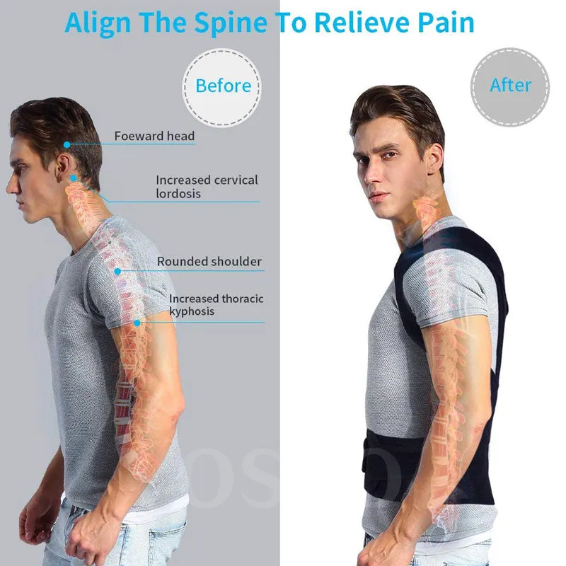 Posture Corrector Back Posture Brace Clavicle Support - Motionshop